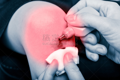 腿,儿子,母亲,急救包,身体受伤,四肢,水平画幅,瘀伤,特写,运动员
