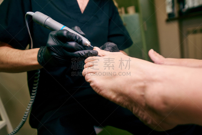 药,足,门诊部,横截面,专业人员,职业运动员,肮脏的,发型屋,甲真菌病