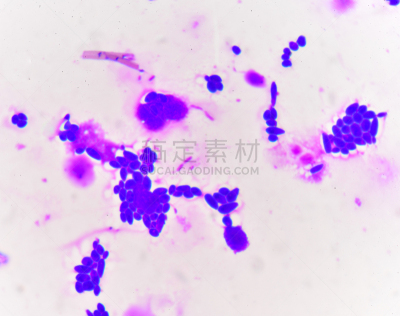 革兰氏染色剂,芽殖酵母,真菌性口炎,真核细胞,显微镜,酵母,微生物学,葡萄酒,生物科技