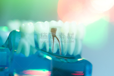 牙医,人的嘴,口腔卫生,人的牙齿,模型,人造的,假牙,水平画幅,无人,使用嘴巴