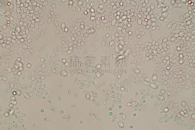 显微镜,酵母,在下面,细胞核,生物科技,水平画幅,微生物学,绝望,科学实验,科学