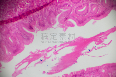 放大效果,胃,在底端,胃腺,动物消化系统,除法,生理学,显微镜,科学实验,动物身体部位