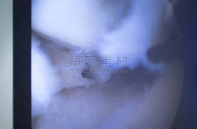 显示器,关节镜手术,医疗保险,拍摄场景,水平画幅,无人,健康保健,手术器械,图像