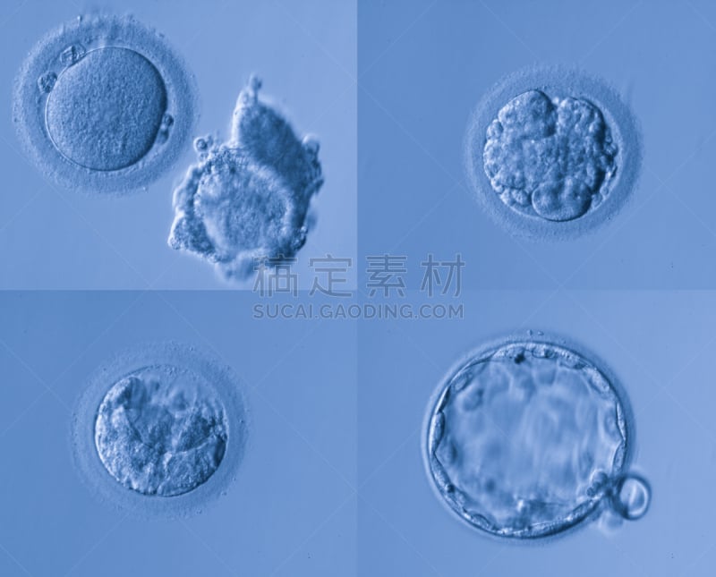 人类兹戈特,胚胎,显微图片,染色体,生物科技,水平画幅,微生物学,无人,科学实验,科学