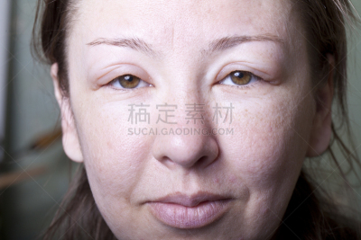 女孩,river ill,青光眼,头痛,水平画幅,白人,结膜炎,疲劳的,人的鼻子,人的眼睛