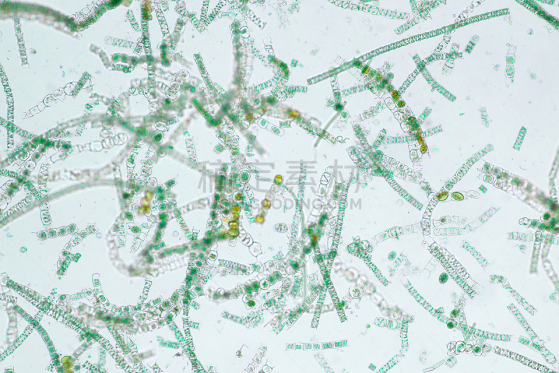 藻类,植物细胞,透明,项链,公亩,一个物体,长的,显微镜,水