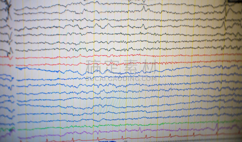 脑部,电,脑电图,问题,儿科医师,显示器,病人,奇异的,神经系统,水平画幅
