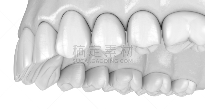 绘画插图,人,牙齿,三维图形,人的牙齿,准确,口腔卫生,健康保健,形态学,二叶