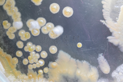 皮氏培养皿,大群动物,细菌,微生物学,个性,土样,盘子,实验室,教育,生长