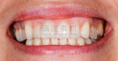 自然美,齿饰,牙龈,关闭的,假牙,牙齿美白,正面视角,水平画幅,人的嘴,干净