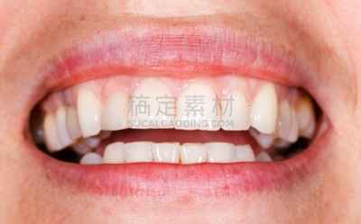 自然美,齿饰,牙龈,假牙,牙齿美白,正面视角,美,水平画幅,人的嘴,白人