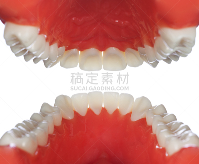 牙科模具,牙冠,牙移植,牙龈,解剖模型,假肢,假牙,颌骨,人造的,水平画幅