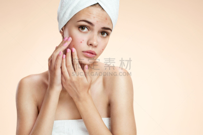 疙瘩,人的脸部,少女,水平画幅,残酷的,特写,米色,成年的,多云,面膜