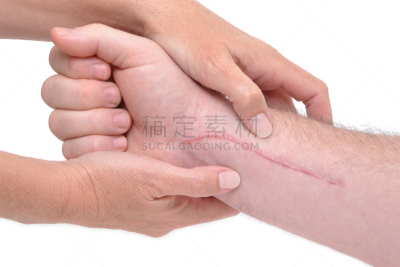 疤,手腕,手臂,特写,长嘴雀鳝,替代疗法,辅导讲座,四肢,水平画幅