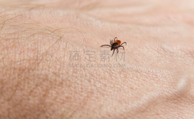 鹿蜱,大特写,黑色,水平画幅,手,人,身体活动,头发,动物