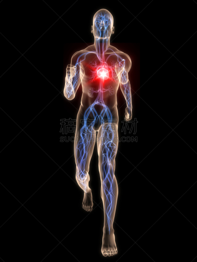 心脏病发作,垂直画幅,X光,绘画插图,X光片,健康保健,生物学,炎症