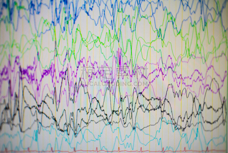 脑部,电,脑电图,问题,儿科医师,显示器,病人,奇异的,神经系统,水平画幅