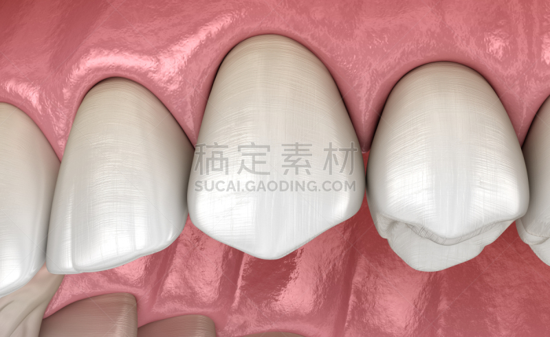 绘画插图,人,牙齿,准确,三维图形,人的牙齿,口腔卫生,健康保健,形态学,二叶