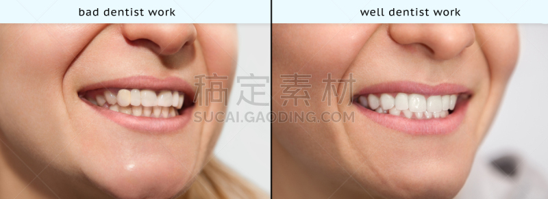 女人,口腔卫生,假肢,井,牙冠,彩妆,盾,实验室,白色,技术