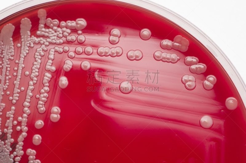 细菌,大群动物,血琼脂,盘子,圆形,水平画幅,形状,微生物学,科学