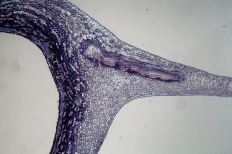 显微镜,寄生的,植物,在下面,植物细胞,生物学,微生物学,显微图片,维管束,细胞