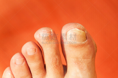 指甲,足,手指,美容用具,特写,咬碎,疣,趾甲,咬指甲,钉子