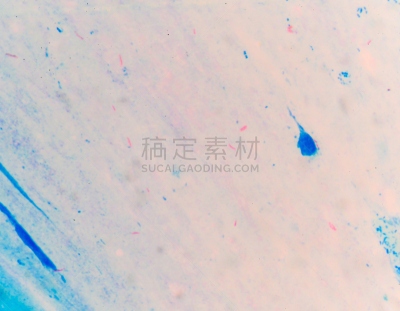 结核杆菌,动物,细菌,分枝杆菌,艾滋病,水平画幅,有毒生物体,科学,面部表情,分析