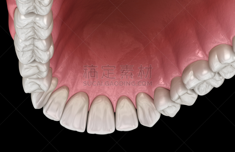 人,绘画插图,牙齿,准确,三维图形,人的牙齿,人的嘴,假牙,牙医,顶部