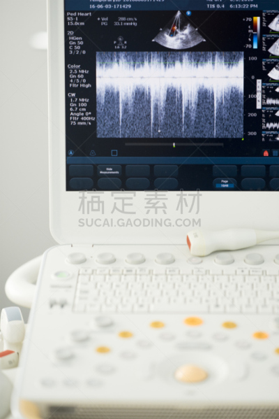 超声波,制造机器,现代,房室瓣,僧帽瓣,3d超声,解剖阀,心室,3d扫描,主动脉