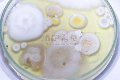 皮氏培养皿,大群动物,细菌,微生物学,个性,土样,盘子,实验室,教育,生长