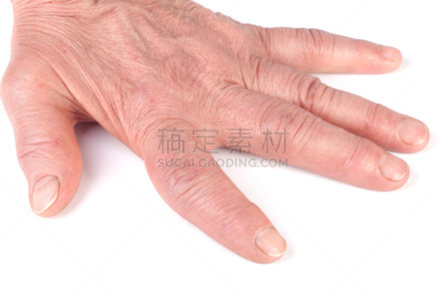 风湿病,白色背景,分离着色,强直性脊柱炎,骨关节炎,拐杖,不明确的地点,关节炎,失眠症