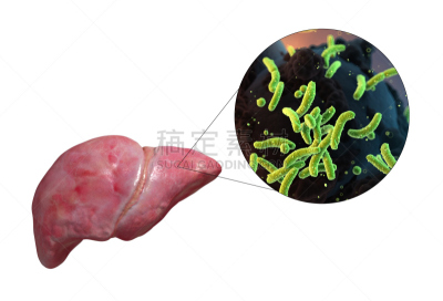 三维图形,肝脏,水平画幅,微生物学,绘画插图,科学实验,科学,生物学,细菌