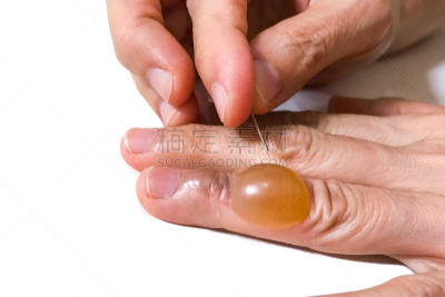 尖利,特写,针,痛苦,手指,水泡,炎症,液体,水,水平画幅