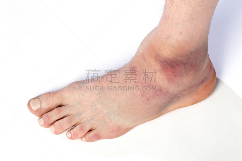 麻烦,水平画幅,无人,健康保健,扭伤,摄影