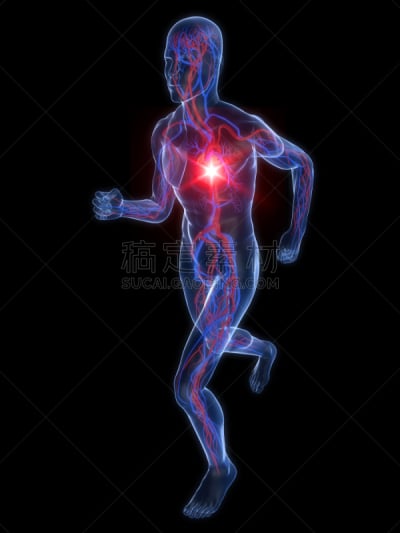 X光,心脏病发作,平衡折角灯,垂直画幅,绘画插图,X光片,科学,健康保健