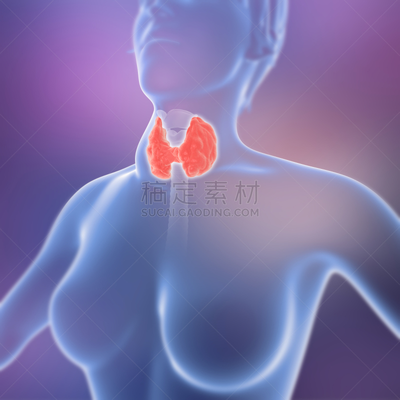 Goiter,甲状腺,三维图形,雌性动物,人,甲亢,喉,荷尔蒙,甲状腺机能减退