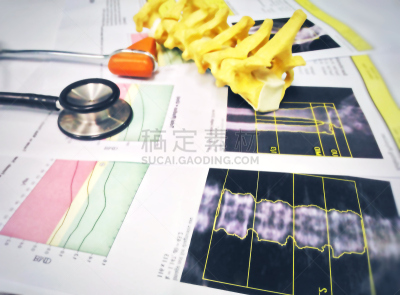 图像,骨密度,膝,特写,报告,柔和,运动模糊,听诊器,模型,穿衣服