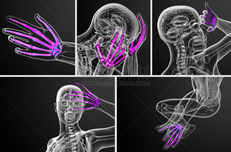 人类骨架,三维图形,手,绘画插图,趾骨,风湿病,骨质疏松症,关节炎,水平画幅,泰国