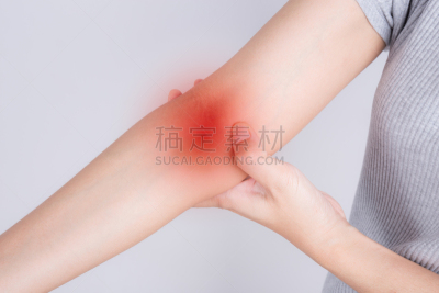 肘,痛苦,女人,卡尔皮,肌腱,炎症,风湿病,慢性疾病,关节炎,身体受伤