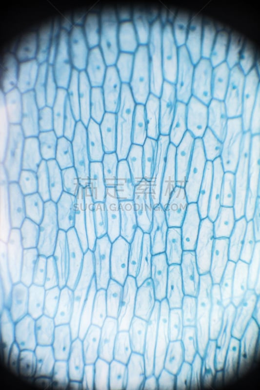 洋葱,细胞,放大效果,根部,顶部,显微图片,中期,有丝分裂的,着丝粒,后期