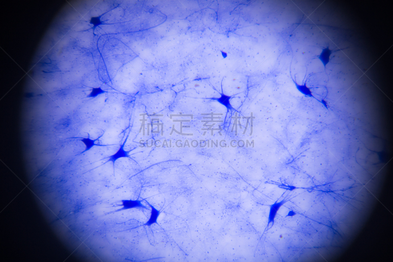 神经元,放大效果,脊髓神经,运动神经元,轴突终端,中枢神经系统,树突,癌,受体,形态学