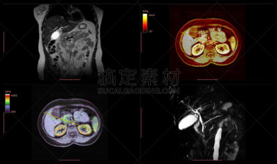 放射科专家,健康保健,腹部,磁共振成象扫描,磁铁,决心,3d扫描,超声波,专门技术,护士