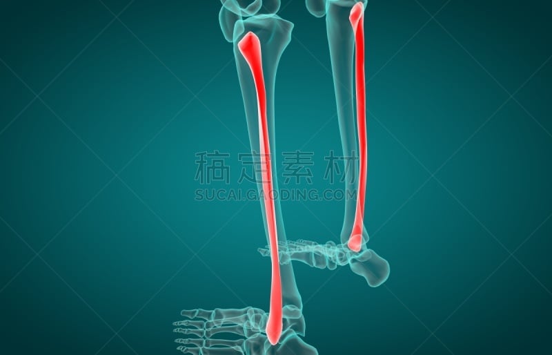 腓骨,三维图形,x光,健康保健,绘画插图,概念,腰部以下,胫骨,痛苦