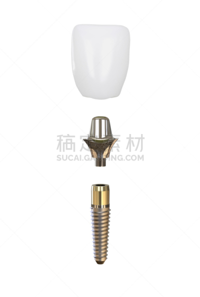 牙移植,人的牙齿,模型,垂直画幅,牙冠,假牙,假肢,根部,隆胸手术,绘画插图