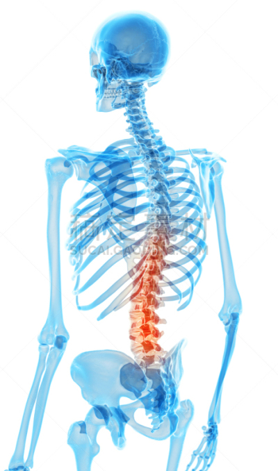绘画插图,健康保健,垂直画幅,科学,计算机制图,计算机图形学,生物学,肩胛骨,骨盆,痛苦