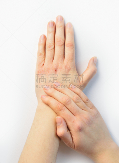 手,垂直画幅,衰老过程,健康,真皮层,干的,仅成年人,皮炎,冬天