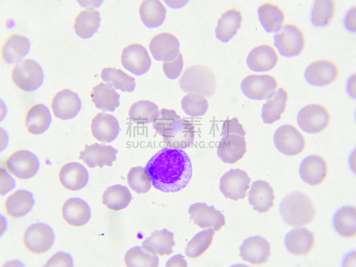 白细胞,成血细胞形成,海洋性贫血,嗜碱细胞,单核细胞,嗜曙红细胞,嗜中性粒细胞,形态学,血小板,贫血症