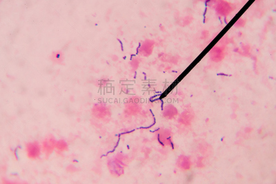 玷污的,毛缘,鞭毛,核糖体,细胞质,人体子宫,皮氏培养皿,生物学,微生物学,显微镜