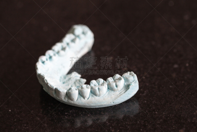 假牙,模型,牙冠,石膏肥料,假肢,选择对焦,人造的,水平画幅,大特写,图像聚焦技术