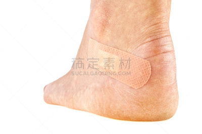 创可贴,特写,足,滑板公园,妇女问题,问题,女人,绷带,水泡,踝